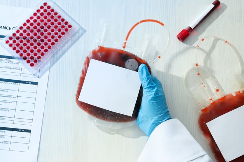 Manejo de síndromes mielodisplásicos en Guatemala