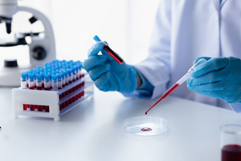 Procedimientos hematológicos en Guatemala